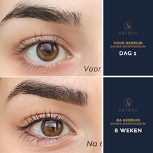 Load image into Gallery viewer, Skines™ Premium Lash Serum – Lash Growth Enhancer