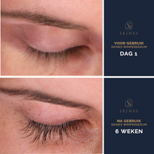 Load image into Gallery viewer, Skines™ Premium Lash Serum – Lash Growth Enhancer