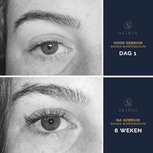 Load image into Gallery viewer, Skines™ Premium Lash Serum – Lash Growth Enhancer